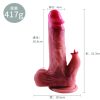 Dương vật có chức năng M20